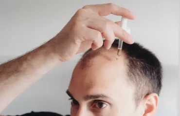 Minoxidil