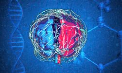 Boala de neuron motor